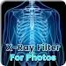 XRAY照片滤镜app(Xray Filter for Photos)